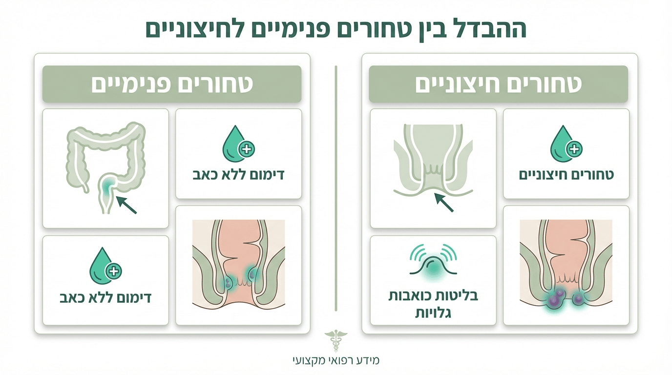 טחורים פנימיים וחיצוניים - ההבדל בטיפול