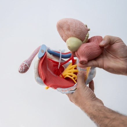 דיאגרמה אנטומית של שרירי רצפת האגן הגברית והערמונית - קורס הכנה לכריתת ערמונית"